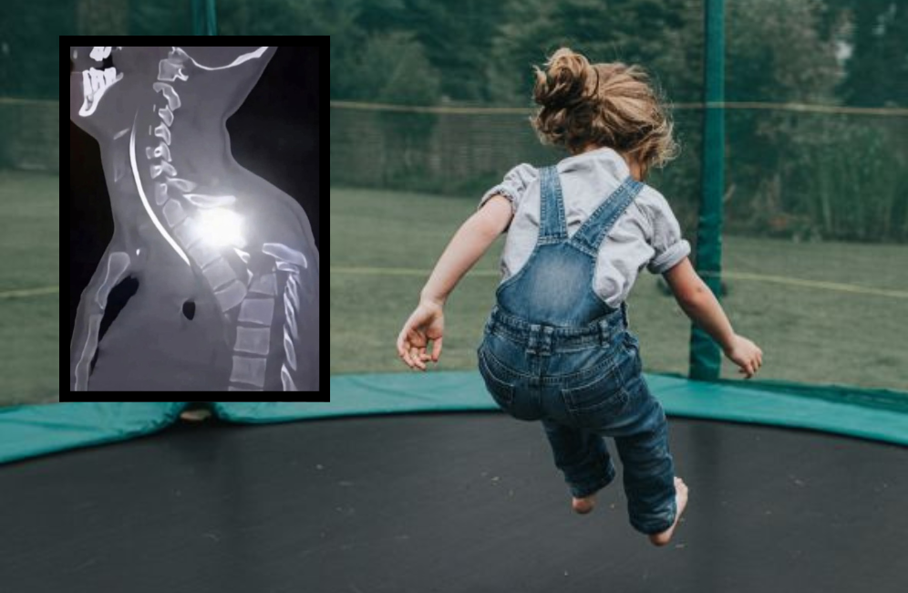 'Anak saya lumpuh sebab katil anjal...jangan ulang silap saya' – Ibu kongsi detik hitam majlis hari jadi anak bertukar tragedi